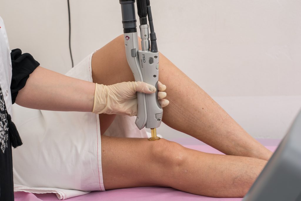 SHR הסרת שיער בלייזר לעור רגיש